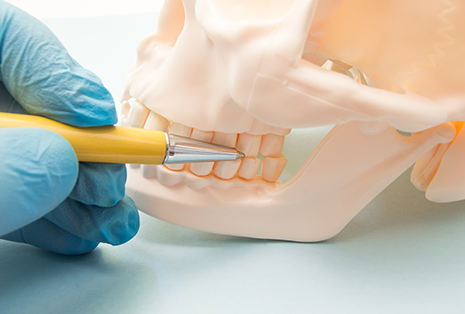 歯列接触癖の改善