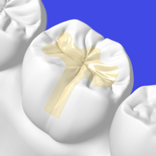 診療内容｜千葉市稲毛区天台の歯科・歯医者 「稲毛おとな・こども歯科クリニック」