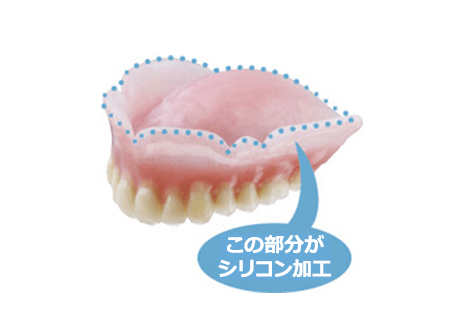 コンフォート義歯（柔らかい生体製シリコン素材）